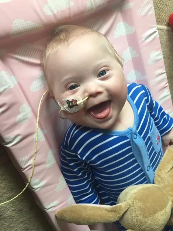 Reuben is lying down on a baby mat. There is a tube hooked in through his nose.